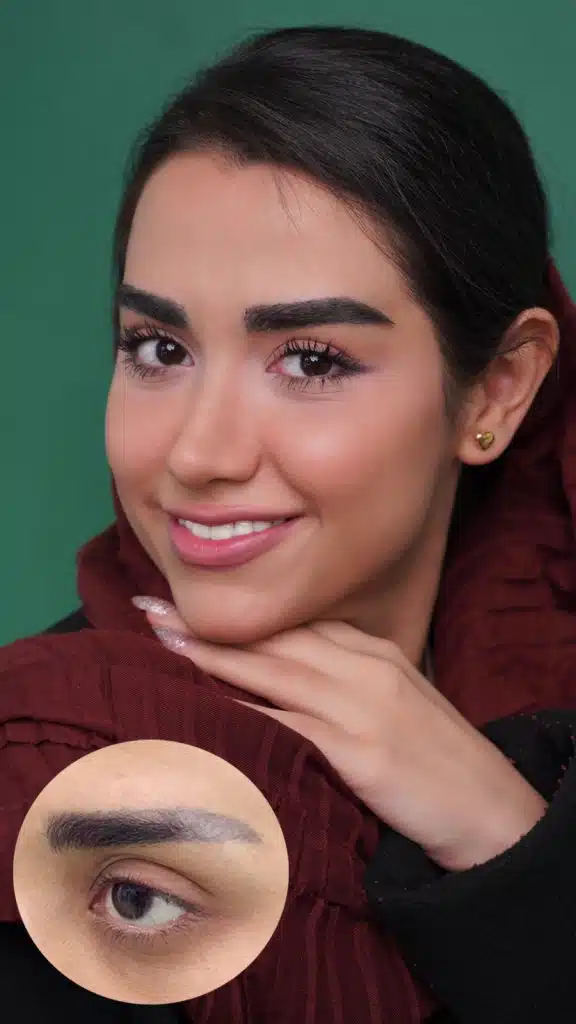 کلینیک گلچهره کاشت ابرو