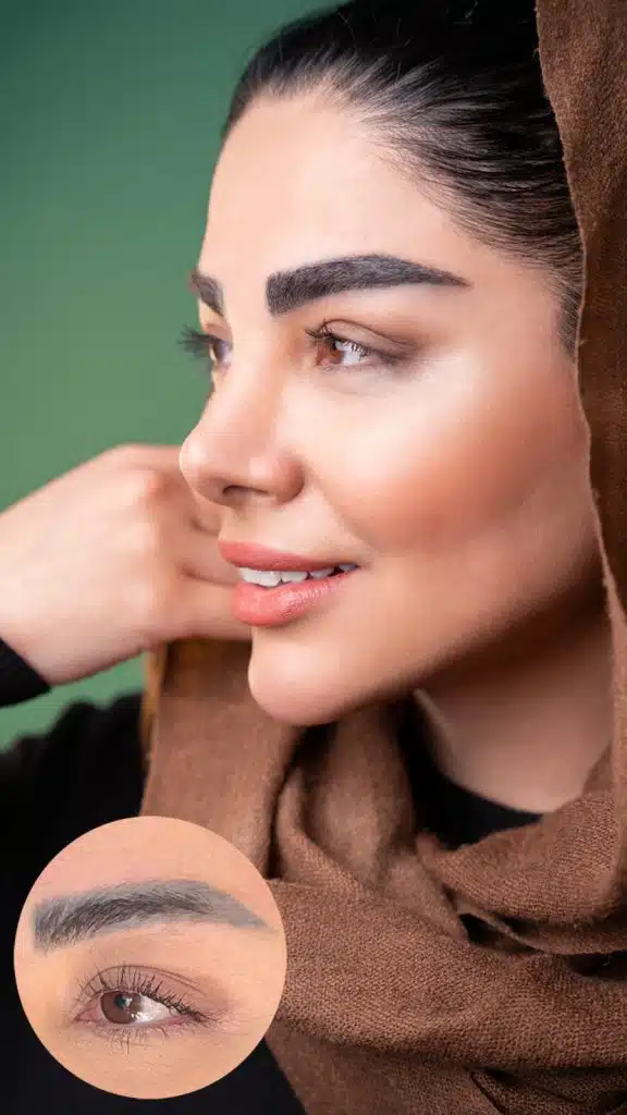 کلینیک گلچهره کاشت ابرو