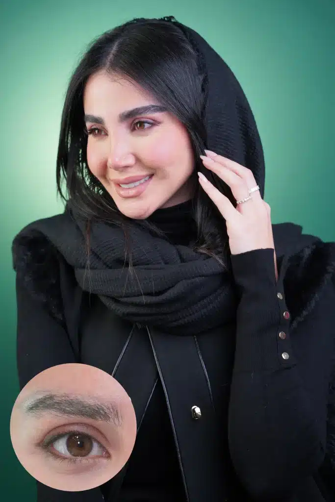کلینیک گلچهره کاشت ابرو
