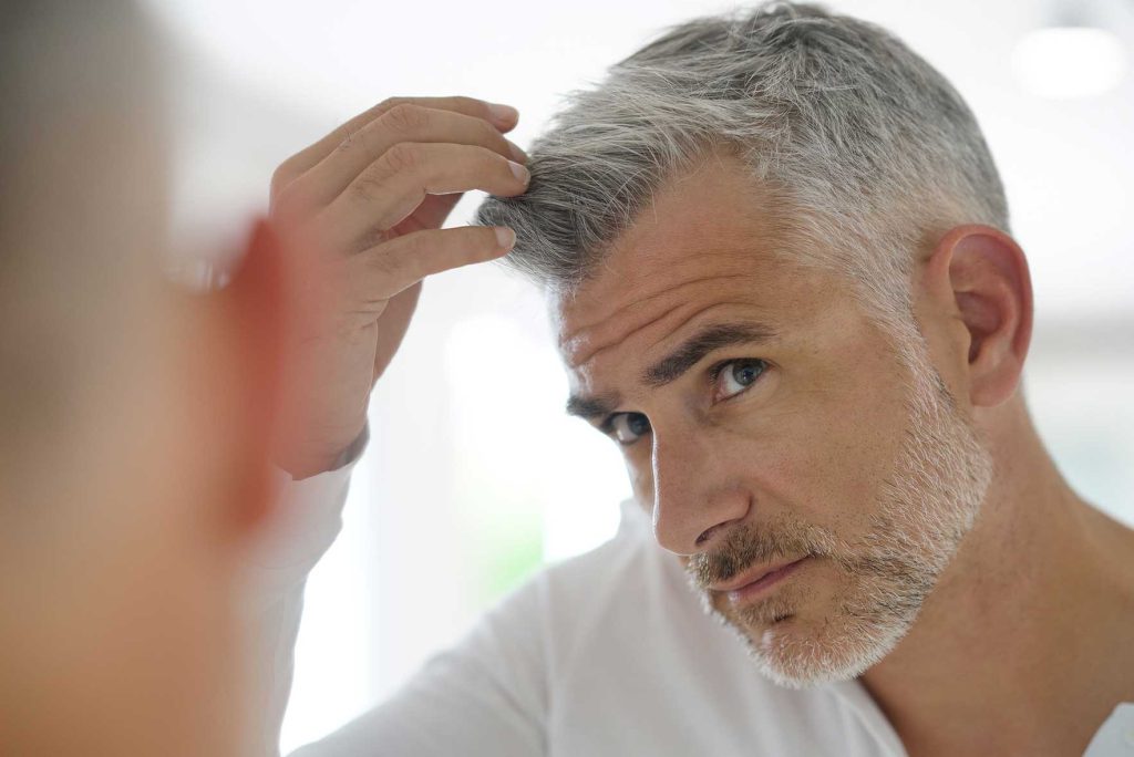bellevue mens hair transplant