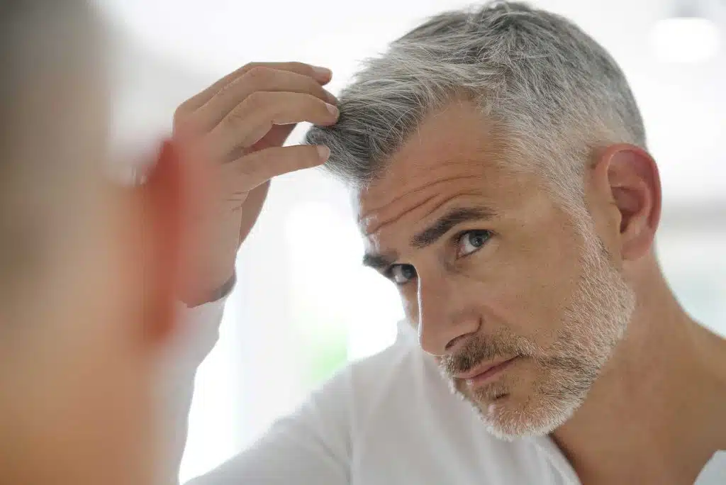 bellevue mens hair transplant