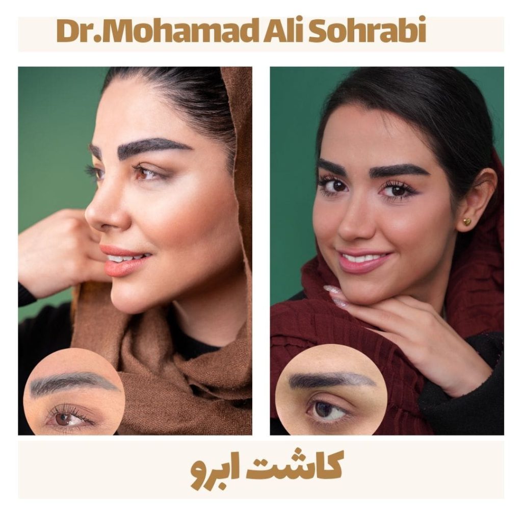eyebrow3 min