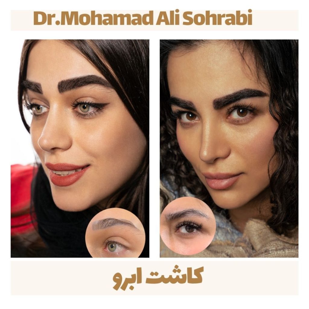 eyebrow4 min