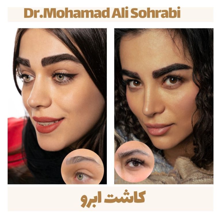 eyebrow4 min