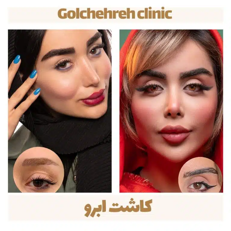 کلینیک گلچهره کاشت ابرو