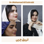 تزریق چربی 1