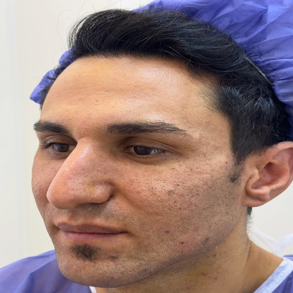 چربی ۱