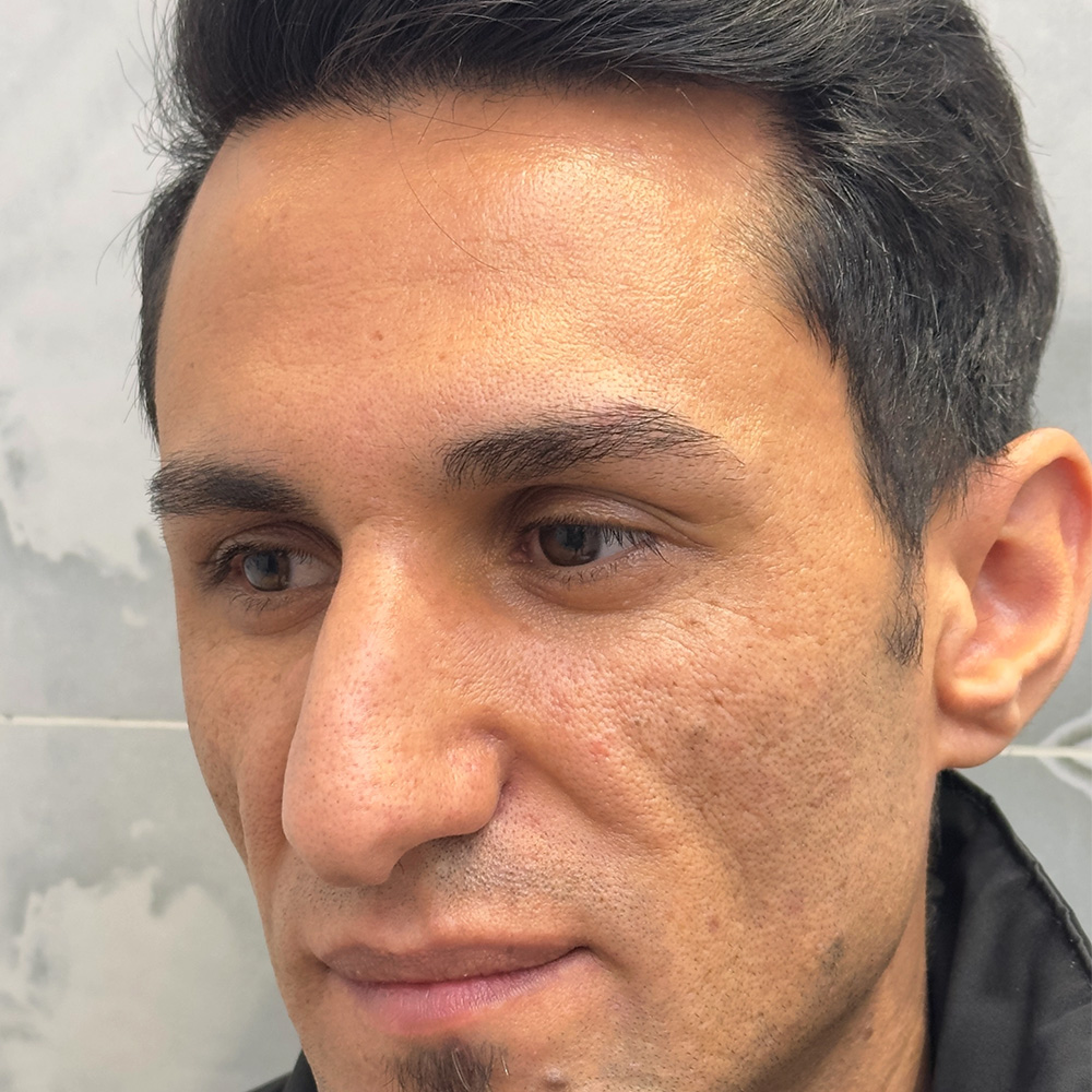 چربی ۲