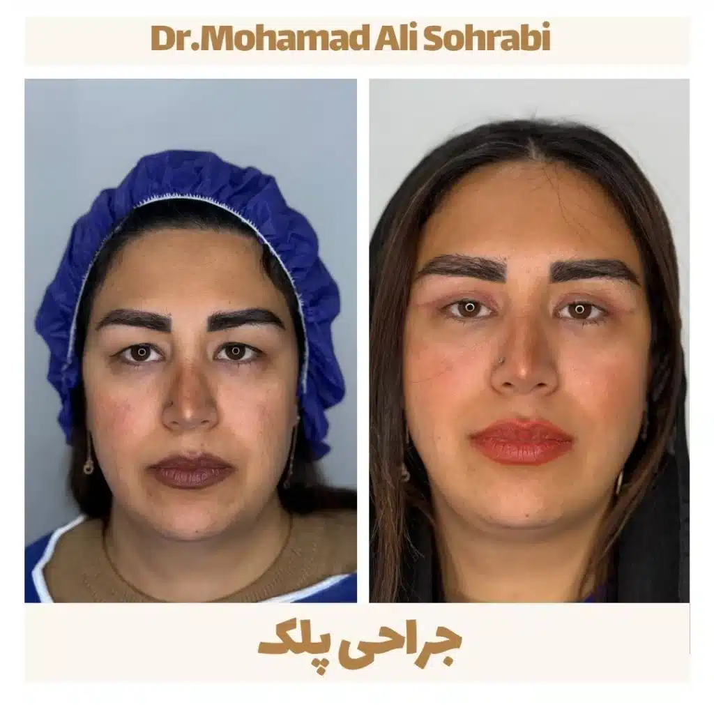 Eyelid Clinic