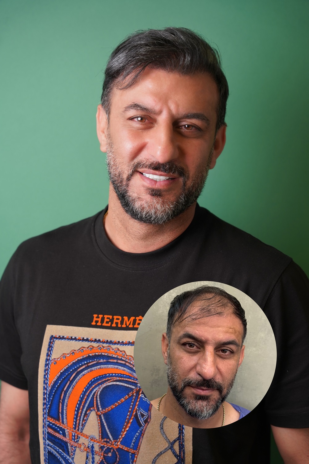 هادی شکوری