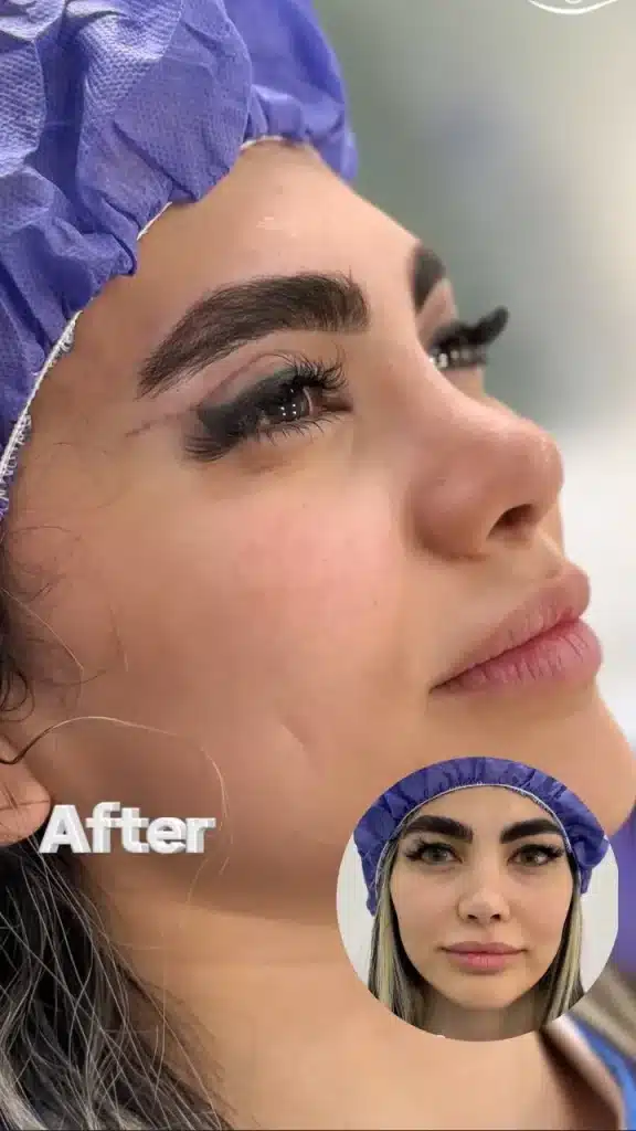 Eyelid Clinic