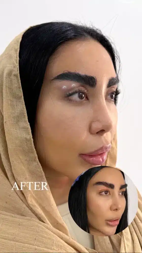 Eyelid Clinic