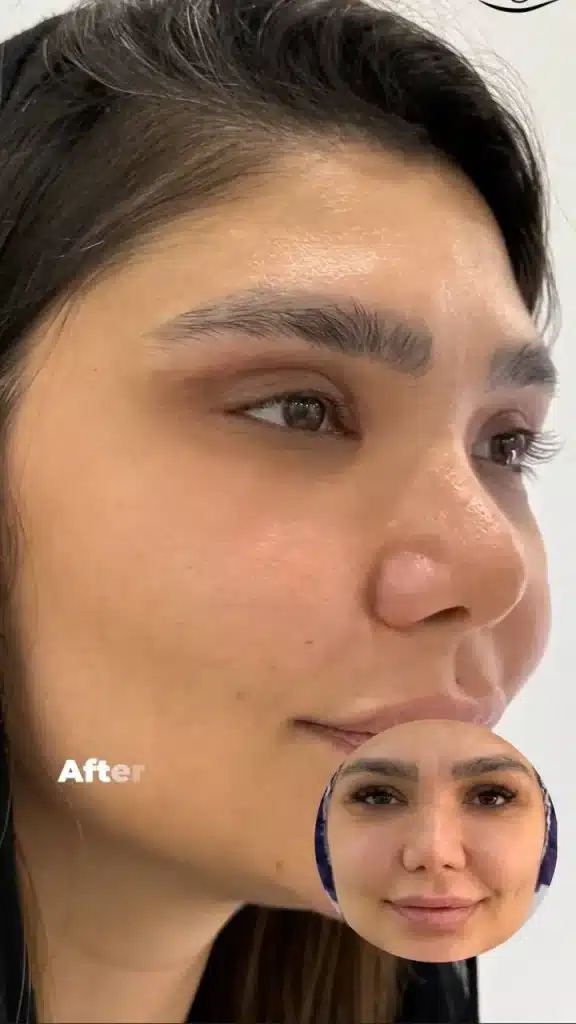 Eyelid Clinic