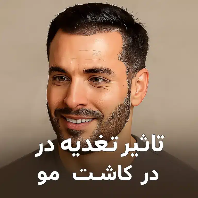 تاثیر تغذیه در کاشت مو