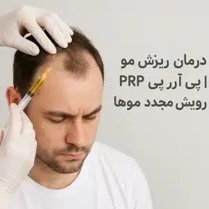درمان ریزش مو