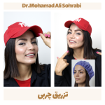 تزریق چربی