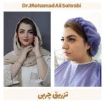 تزریق چربی 10 تزریق چربی 7